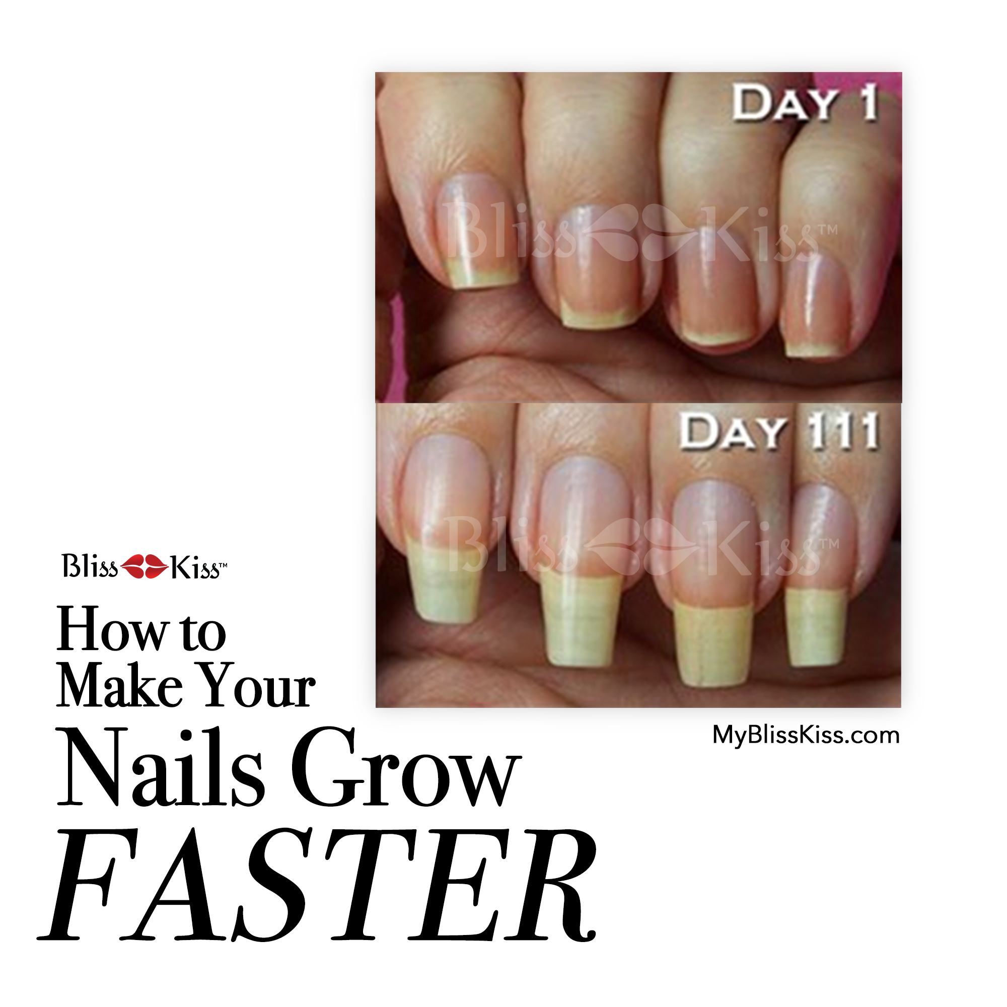 How to Make Your Nails Grow FASTER! - Bliss Kiss by Finely