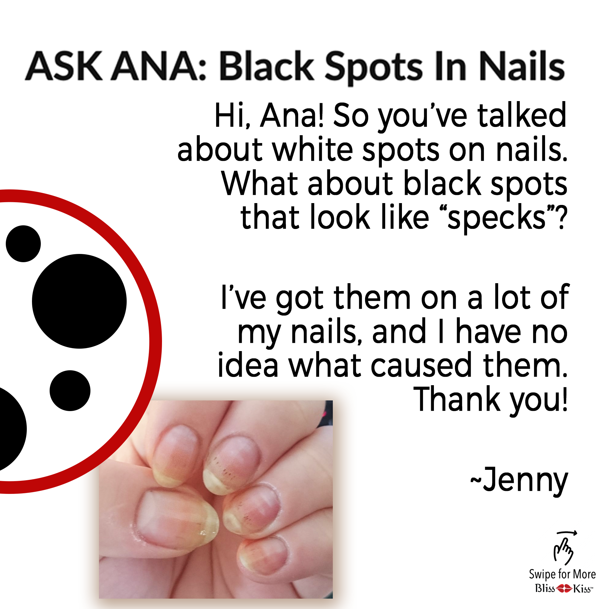 5 Causes of White Spots on Nails (With Images) - GoodRx