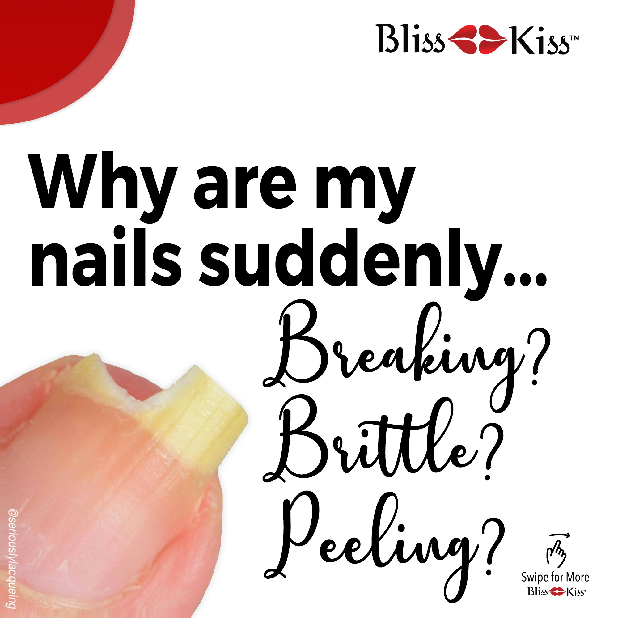 Why are my nails suddenly breaking, brittle, peeling? - Bliss Kiss by  Finely Finished, LLC