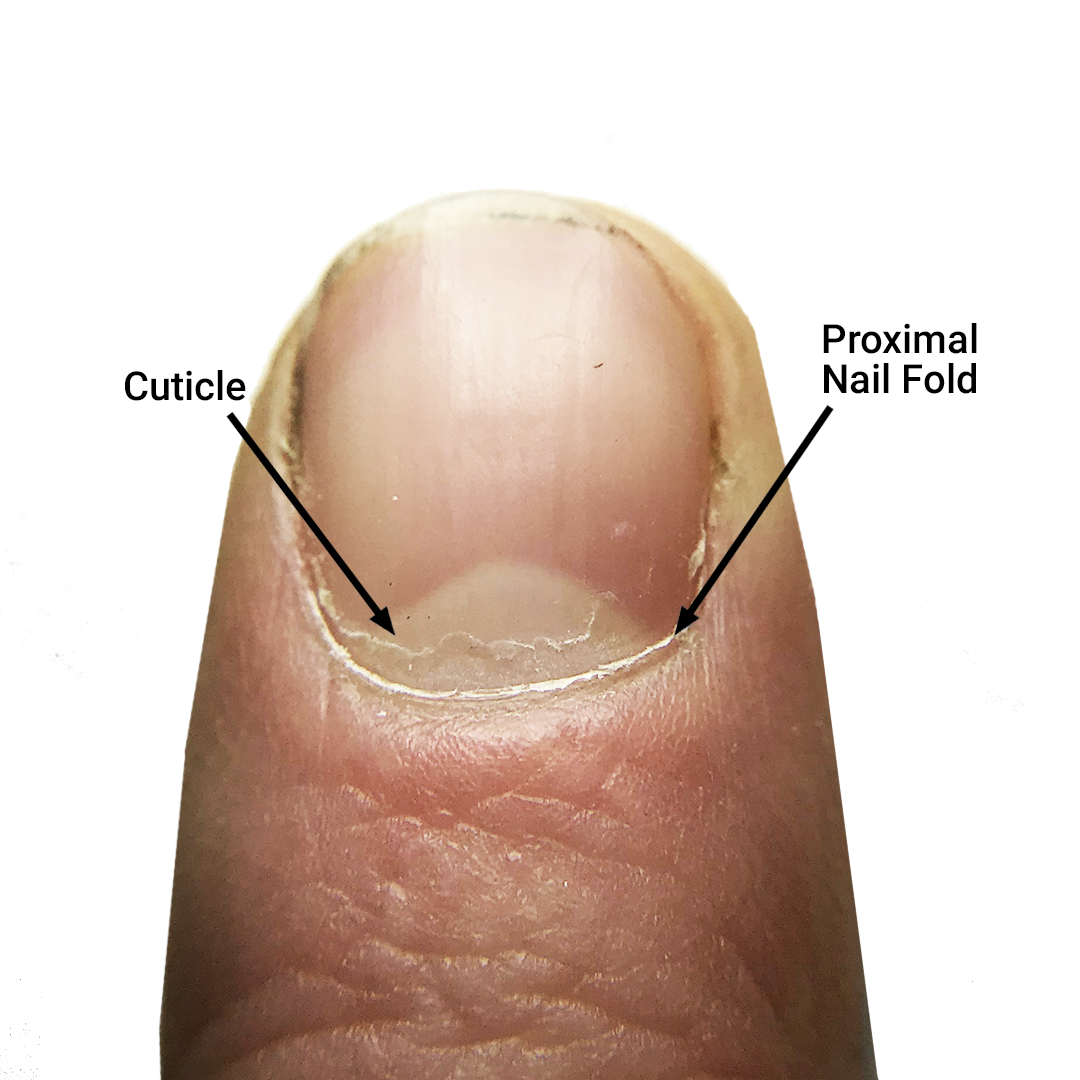 The Cuticle Should You Clip Push Or Scrape Bliss Kiss