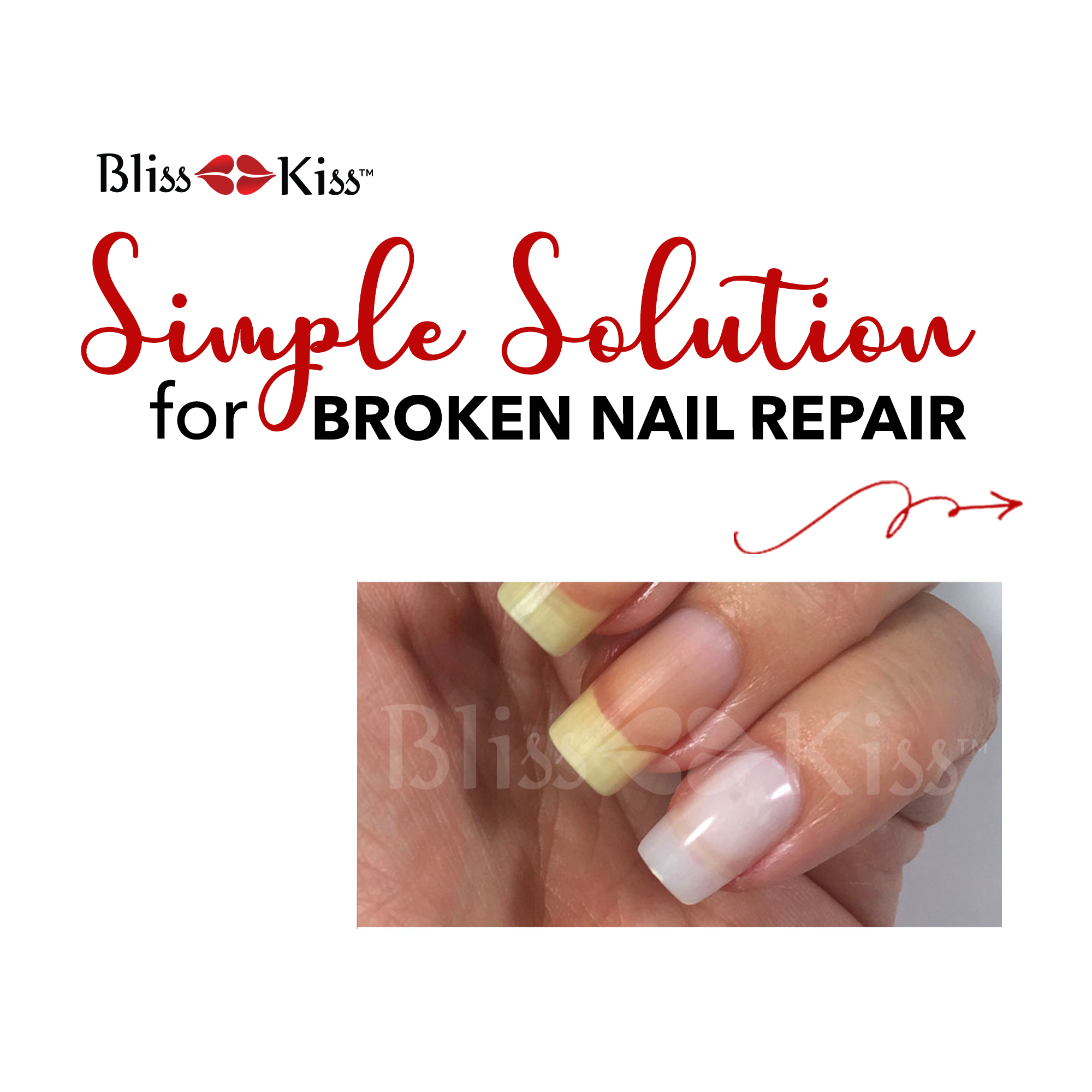 6 Ways Ankylosing Spondylitis Can Affect the Nails | MySpondylitisTeam