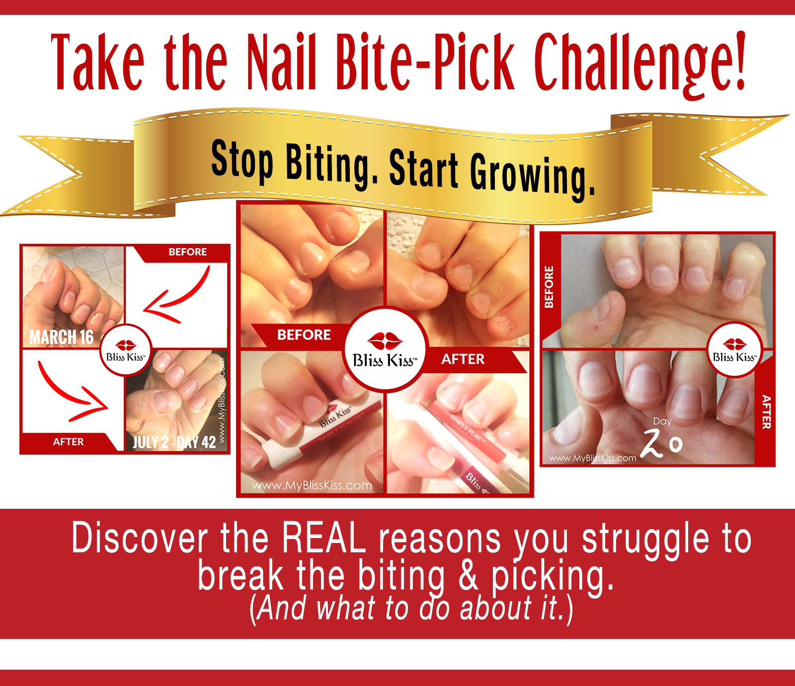 nail-bite-pickchallenge-no-contest.png