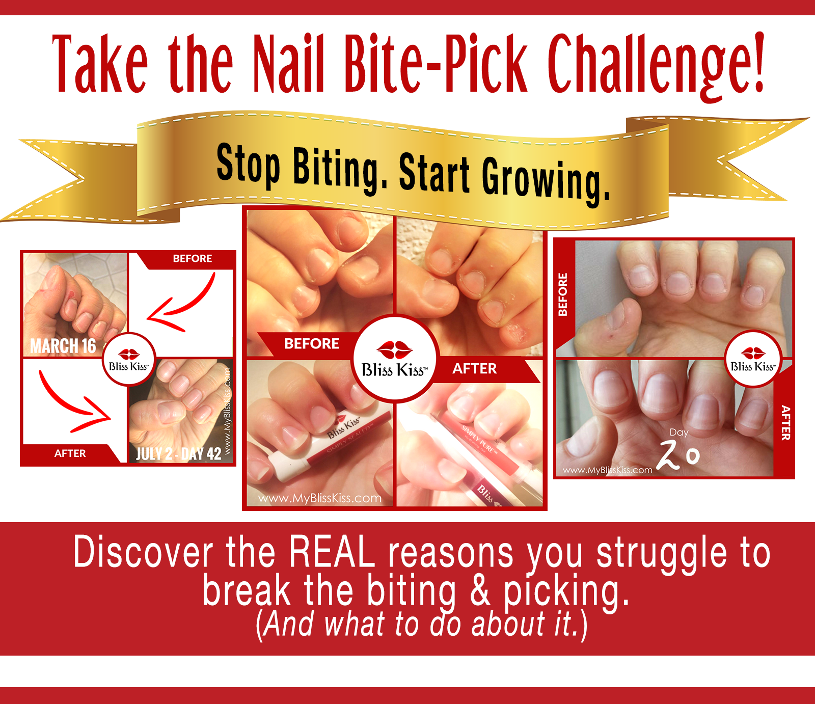 The 11 Best Product to Stop Nail Biting Reviews 2024 – DTK Nail Supply