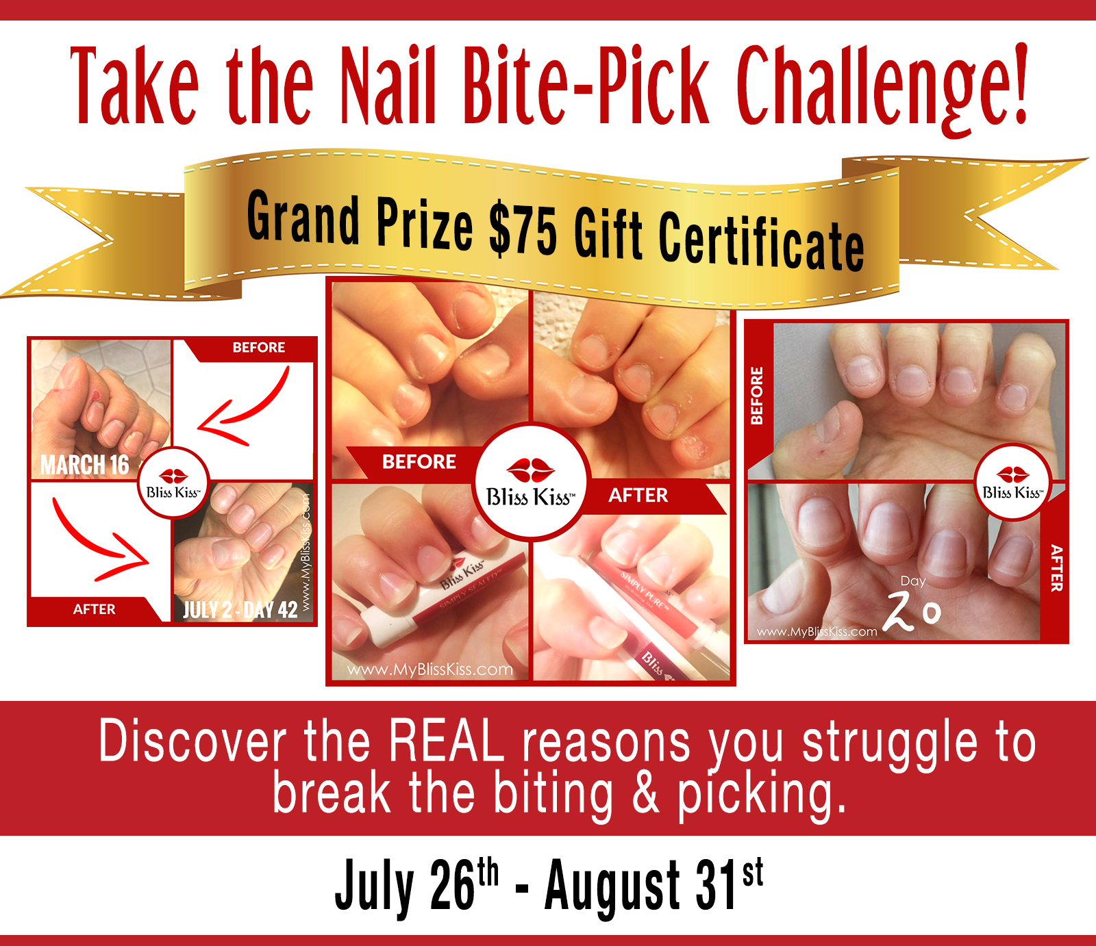 nail-bite-pickchallenge.png