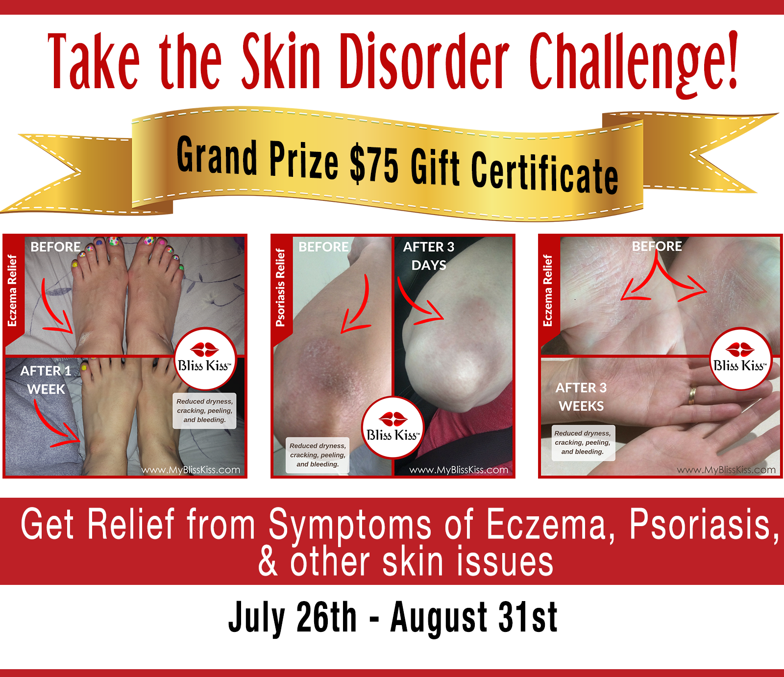 take-the-skin-disorder-challenge.png
